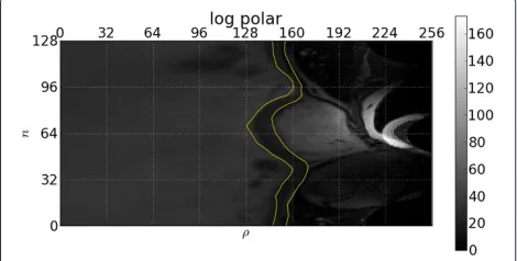 Figure 4 Log-polar transform. Log-polar transform with humanannotated inner and outer contours in yellow