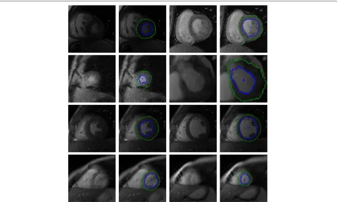 Figure 10 York automatic segmentations. Selection of images and their automatically segmented contours (inner contour is blue and outer isgreen) inferred from a testing set