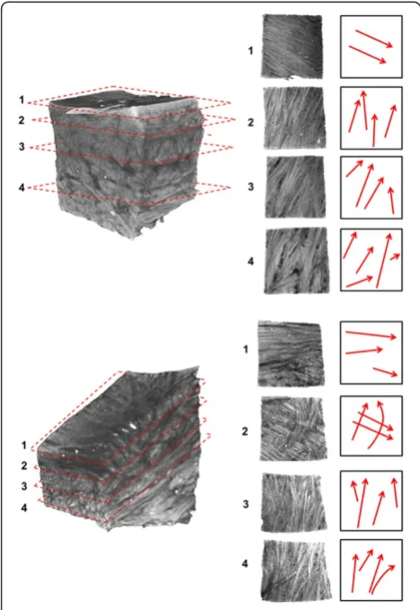 Figure 6 Schematic representation (left) of braided and wovenfascicle organizations with associated sections from meniscalsamples illustrating these arrangements (right)