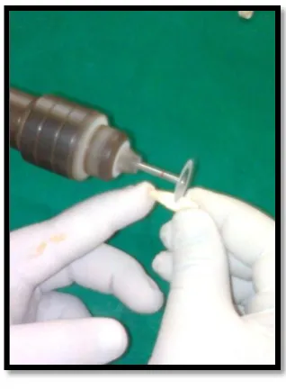 Fig 15 Autoclaved specimens             Fig 16 Infection of root canals 