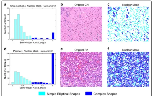 Figure 6 Fourier shape features discriminate simple and complex shapes in histological renal tumor images