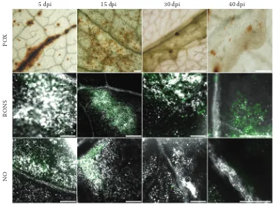 Figure 8. Volume model of signal for RONS (green) was reconstructed from a series of eight optical sections through PEMV-infected pea leaf at 40 dpi