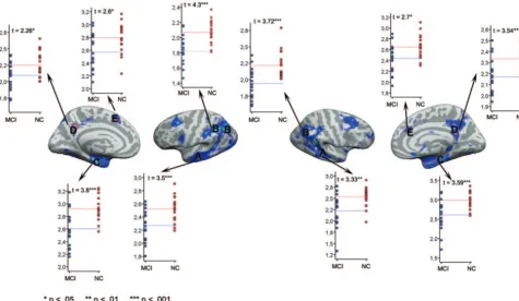 Fig 3. Scatterplots of cortical thickness in patients versus controls. ROIs were chosen on the basis of the results from the cortical thickness comparisons