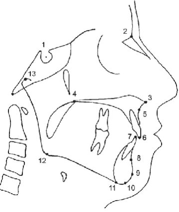 Figure 7. Cephalometric landmarks used in this study, 1 – Sella (S), 2 – 