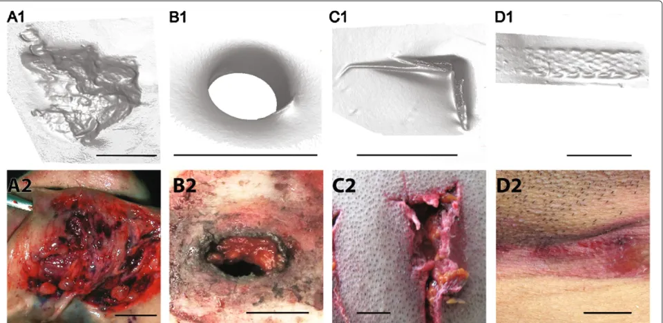 Figure 1 Plasticine models versus real injuries.plasticine blockedges might still be identiﬁable
