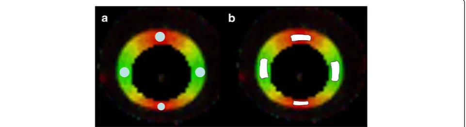 Figure 4 ROIs in the phantom images. ROI placements on axial FA color maps in the phantom with the circular (a) and freehand (b) methods.