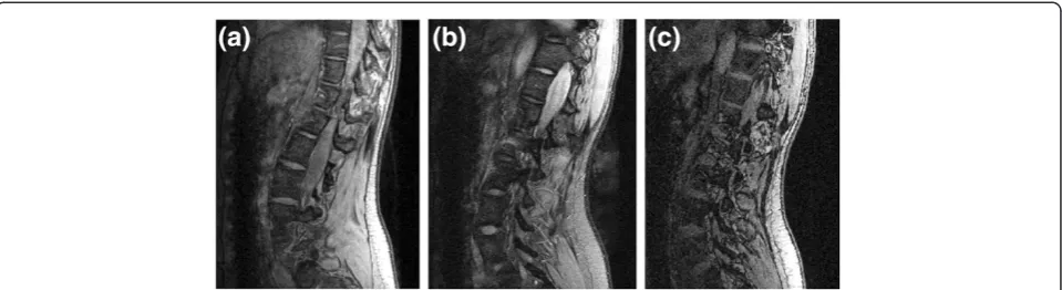 Figure 1 MRI acquisition protocols. Three different acquisition sequences for the same patient from the medium scoliotic severity group: (a)3D MEDIC, (b) 2D Spin Echo, (c) 3D FISP.