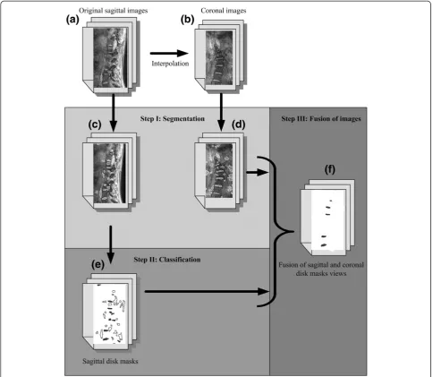 Figure 3 Flowchart of the novel automatic segmentation process. Flow chart of the different steps necessary to obtain the finalreconstruction of the intervertebral disks.