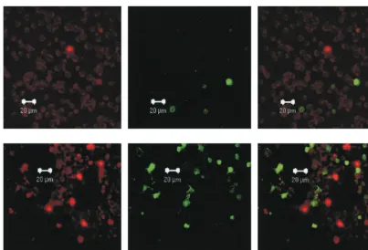 FIG. 5. Cells expressing lytic EBV antigens and TUNEL-positive cells are mutually exclusive