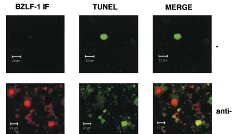 FIG. 7. BZLF1 and TUNEL staining overlap in some Akata 31-p294:Zp-552Xwt cells. Control untreated (�Akata 31-p294:Zp-552Xwt cells were analyzed for BZLF1 immunoﬂuorescence and TUNEL staining by confocal microscopy