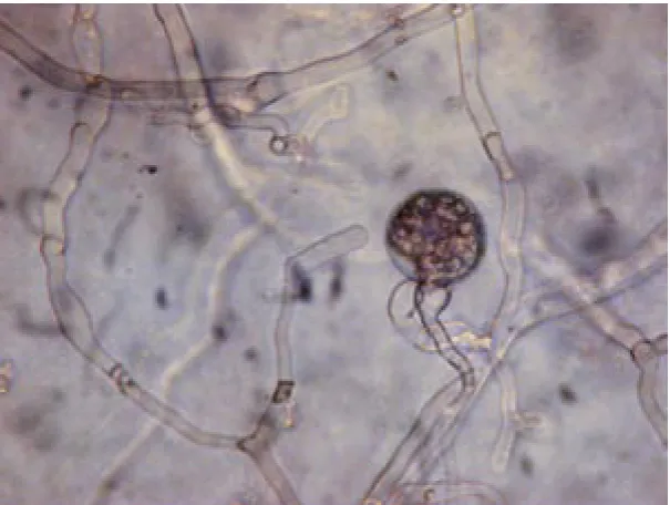 Figure 1. Heterothallic hyphae and  oospore of P. infestans (Orig. microsco-pic photo Mazáková, Táborský)