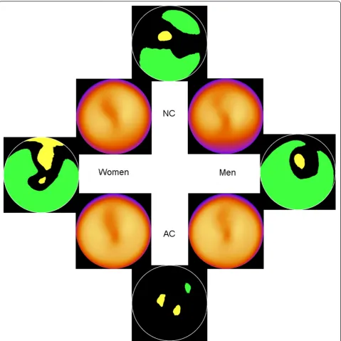 Figure 1 All patients. The 4 inner images show the normal stress databases for NC men, NC women, AC men and AC women