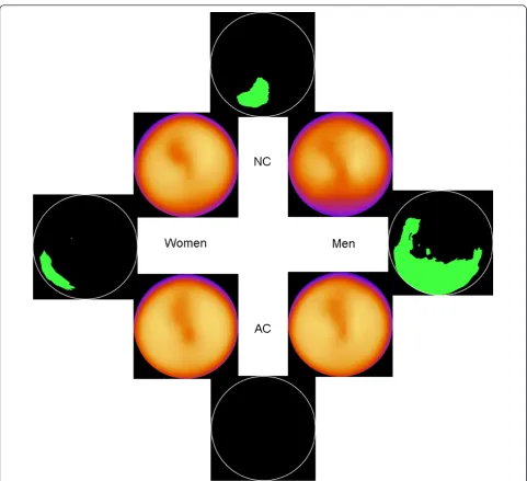Figure 2 Patients with normal weight. The 4 inner images show the normal stress databases for NC men, NC women, AC men and ACwomen