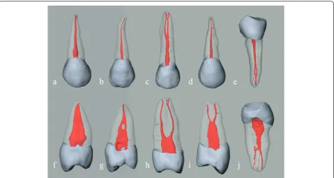 Figure 1 3-D image shows the enamel, dentin, and root canal with surface rendering. Root canal system classification: (a, f) type I ofTooth A, (b, g) type II of Tooth B, (c, h) type III of Tooth C, (d, i) type IV of Tooth D, (e, j) type V of Tooth E