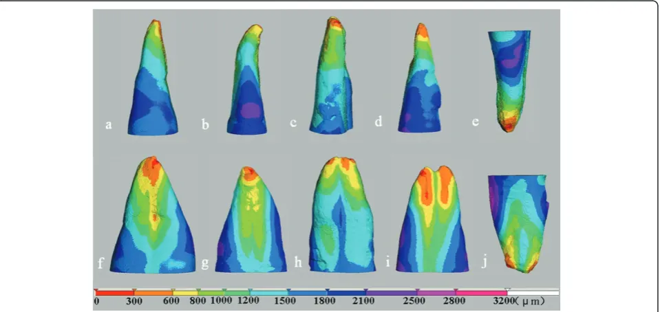 Figure 4 Color-coded distance images showing the changes in canal shape during instrumentation