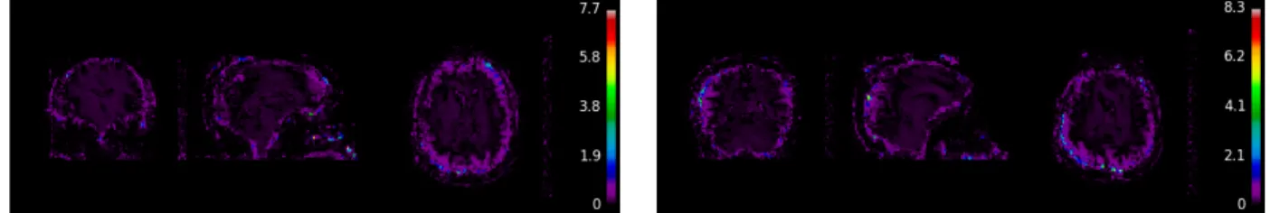 Figure 12 and 13: Examples of Leave One Out (LOO) Visualizations