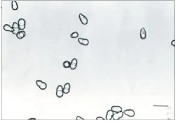 Figure 3. Degree of damage to Pyracantha coccinea fruits by the fungus Spilocaea pyracanthae at the same sites but in different years (2001 and 2002)