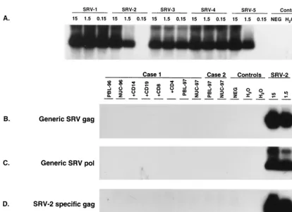 FIG. 2. WB reactivity against SRV-1 and SRV-2 on initial screen-ing in sera from two persons occupationally exposed to NHPs