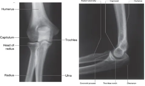 Figures showing the Anteroposterior and Lateral Radiographs of elbow 17 