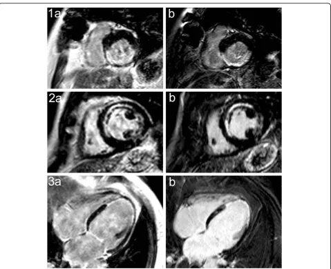 Figure 9 Comparison of synthesized LGE images with actual LGE images. Synthesized inversion recovery images (a) compared with actualinversion recovery images (b) with the same inversion delay plus 20 ms of three different patients