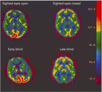 Figure 1.1: Glucose metabolism at rest in sighted and blind individuals. The mean glucose utilization maps are displayed in a 