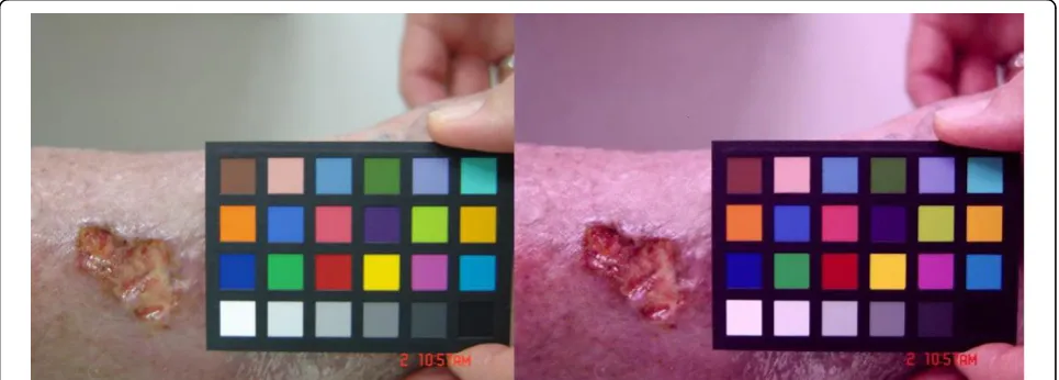 Figure 1 Chronic Wound and Reference Chart. Chronic Wound and Reference Chart after (left) and before (right) calibration.