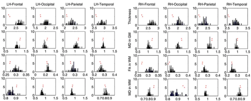 Table 2: Lobar-level analysis of cortical tissue integrity.