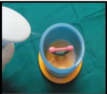 Fig: 41 positioning of silicone casting ring         Fig: 42 Patterns sprayed with surfactant       