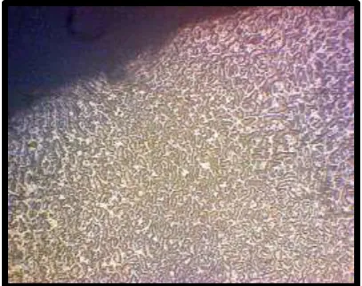 Fig: 68 Metallurgical microscopic image of       Fig: 69 Metallurgical microscopic image               untreated Ni-Cr sample                                             of laser treated Ni-Cr sample  