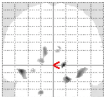 Table 4: White Matter Baseline results