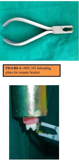 FIGURE 6--#001-343 debonding pliers for ceramic bracket