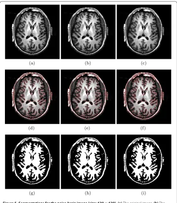 Figure 5 Segmentations for the noise brainsmooth image by Gaussian low-pass ﬁlter with image (size: 630 × 630)