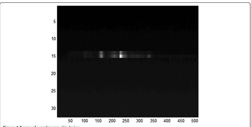 Figure 3 Demonstration of image acquisition. Left: the switch on the probe from which to perform either ‘P’ scan or ‘V’ scan