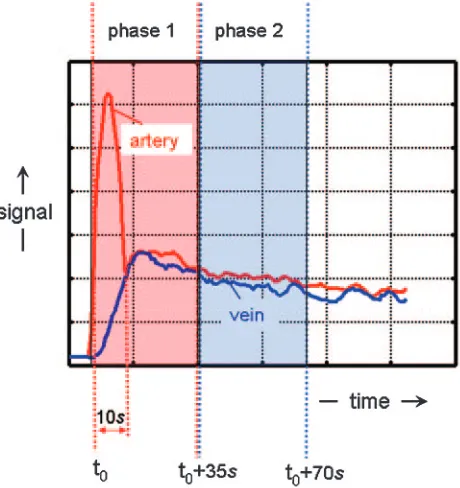 Fig 2. Timing of contrast agent arrival with MR fluoroscopy. By injecting a 2-mL test bolusof gadolinium-based contrast agent and dynamically acquiring every second a single80-mm-thick sagittal section positioned through the aorta, the arrival of the contrast bolusin the abdominal aorta is 23 seconds after injection for this patient.