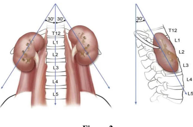 Figure:2 Location and orientation of kidneys in the retroperitoneum 