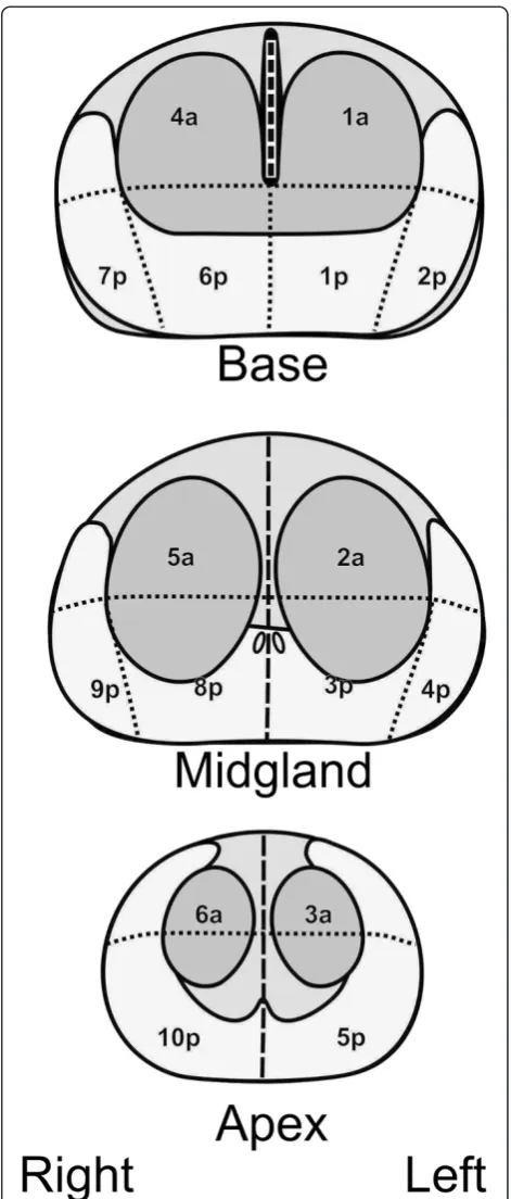 Figure 1 Prostate segmentation showing ten posterior and sixanterior segments.