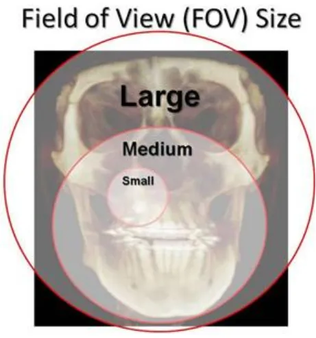 Fig 2: CBCT scanners with different Field of views -small, medium & large. 