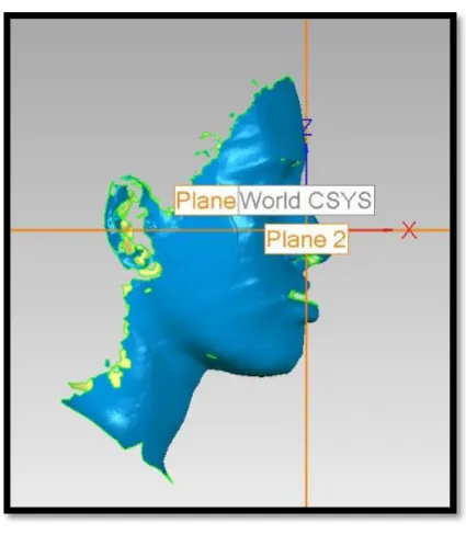 Fig.18: FRONTAL VIEW 