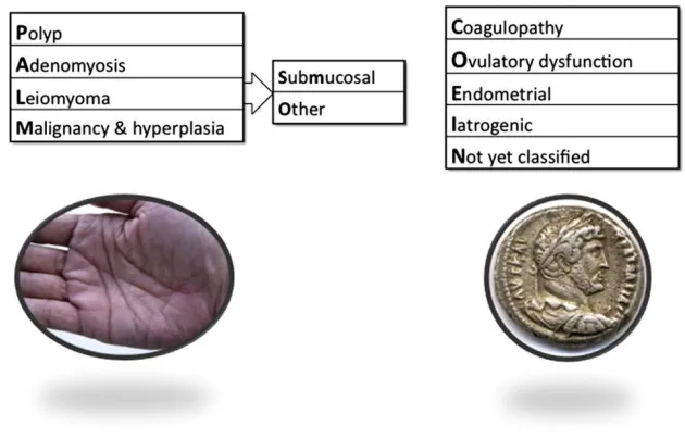 Figure 1: FIGO CLASSIFICATION OF AUB 
