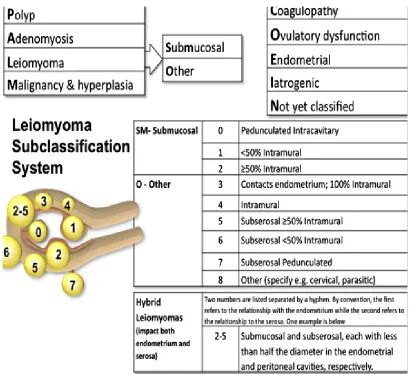Figure 2 : Leiomyoma subclassification 