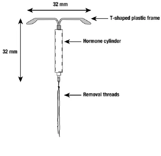 Figure 5 : Mirena 