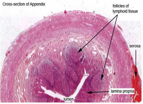 Fig. 3 Cut section of normal appendix - histology 