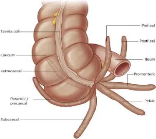 Fig. 5 Variations in the position of the appendix 