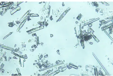 Figure 11: Needle-like crystals from top layer of crucible  