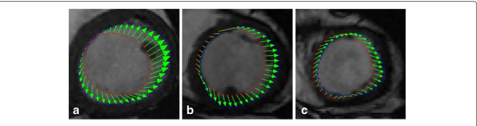 Fig. 13 a, b and c show displacement vectors of different slices of ED for case SC-HF-I-05