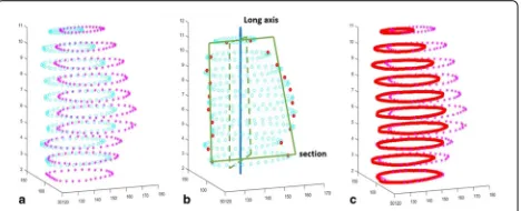 Fig. 1 A MR cardiac image: a 3D heart image after scaling along z axis;b a slice of the 3D image along z axis