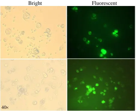 Fig. 4. PCR products of cloned sequences and mRNA transcript. (A) The amplified fragments obtained from the enzymatic digestion of plasmids carrying Core, SP-Core, and GFP genes; (B) The amplified HCV core mRNA transcript (1.6  kb) running on an agarose ge