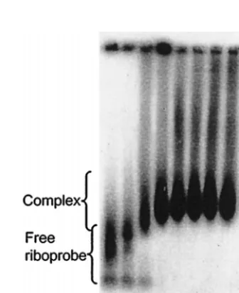 FIG. 2. Characterization of expressed, histidine-tagged BUN N protein. A220-ng (lanes 1 and 5) or 2.2-mg (lanes 3 and 4) sample of puriﬁed N protein was