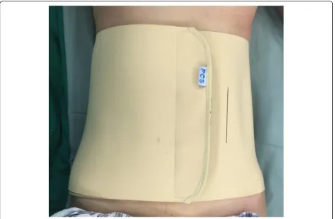 Fig. 4 Elastic waist band worn between the two marked lines