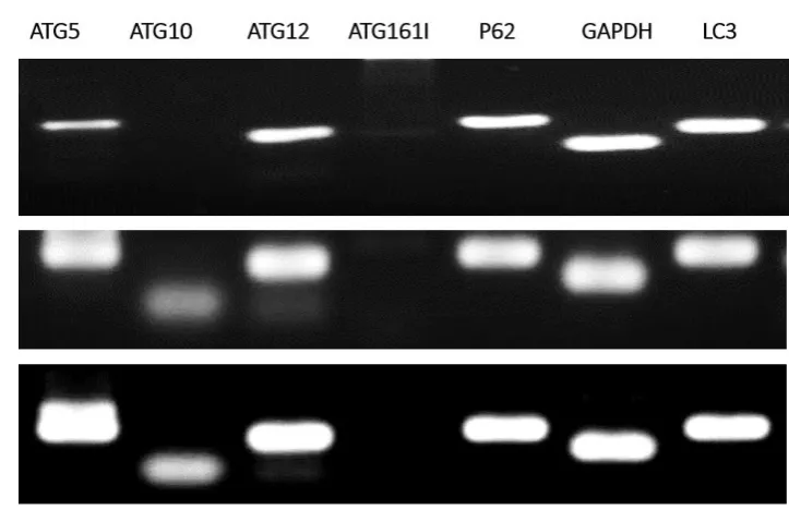 Fig. 2. The RT-PCR  results in three experimental groups. The rows represent the mRNA expression results for ATG12of whereas p62, ATG5, ATG10, , ATG16L1, LC3, and GAPDH in the rat model of Parkinson’s disease (row 1), control (row 2), and sham (row 3) grou